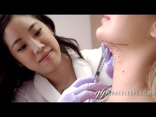 Dr Grace Peng Kybella injections