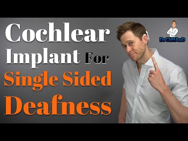 Cochlear Implants for Single Sided Deafness & Asymmetrical Hearing Loss | FDA Approval