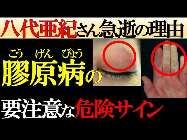 【医師監修】放置厳禁！知らないと後悔する「膠原病」が引き起こす体の変化。八代亜紀さんの急逝の理由や危険サイン・治療法・予防法を徹底解説