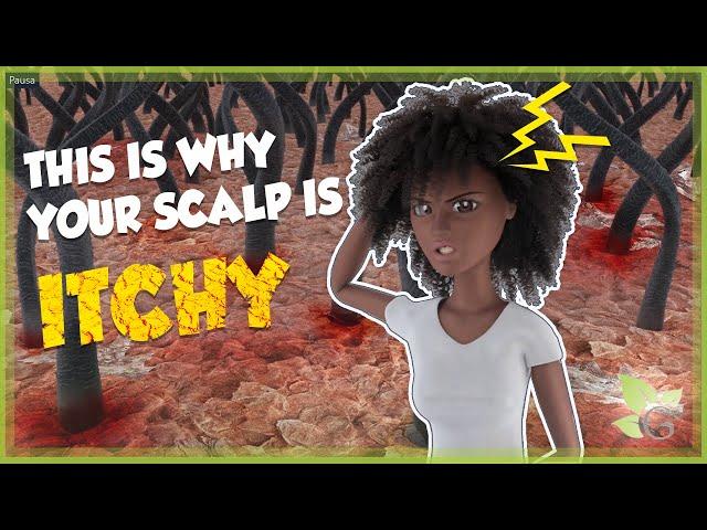 Why your scalp is so damn ITCHY