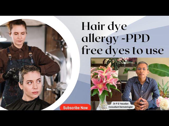 What you NEED to know about hair dye allergy (including PPD free dyes)