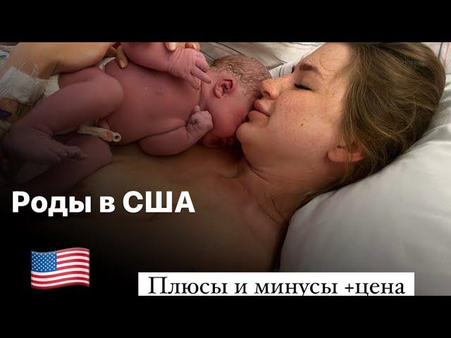 Сколько стоят роды в США ?￼