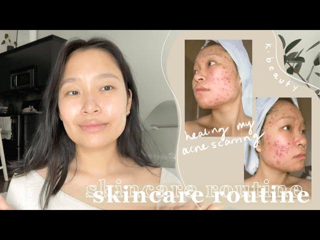 my holy grail skincare routine | how I healed my severe acne scarring, texture & hyperpigmentation