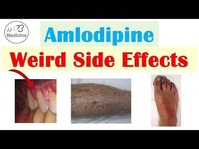 Amlodipine Weird Side Effects (Skin, Gastrointestinal, Psychological)