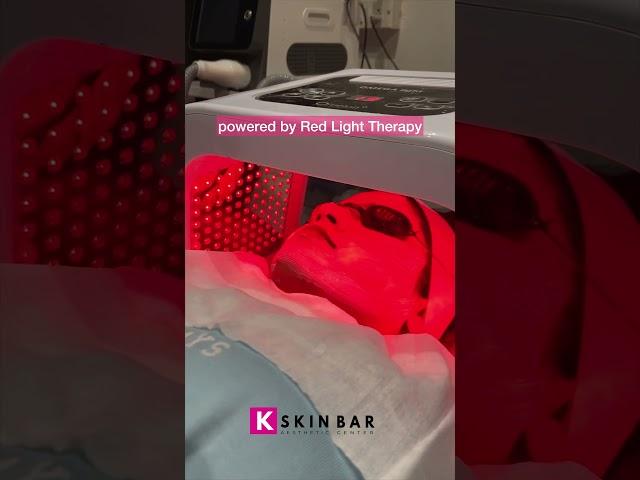 Queens  Facial treatment #glassskin #chemicalpeel #facial #hydrafacial