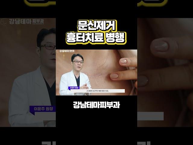 문신제거 흉터치료 병행하면 더 좋은 효과 #문신제거#문신흉터