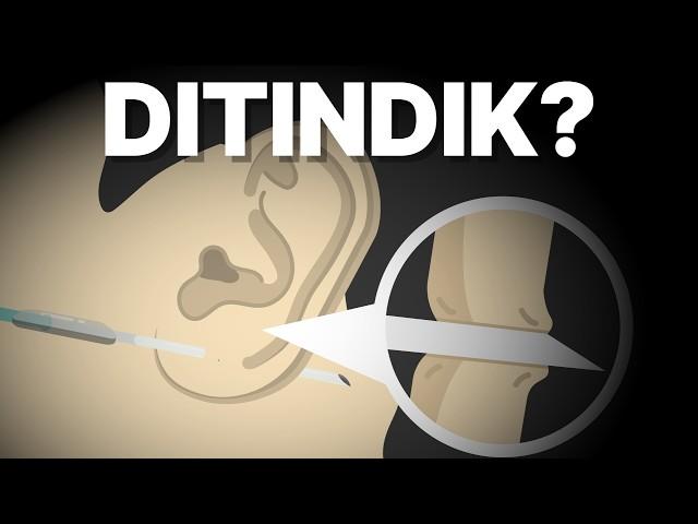 Apa yang Terjadi Saat Kita Ditindik?