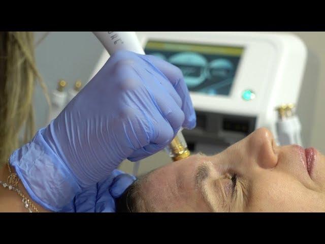 Radio Frequency Facial: What To Expect?