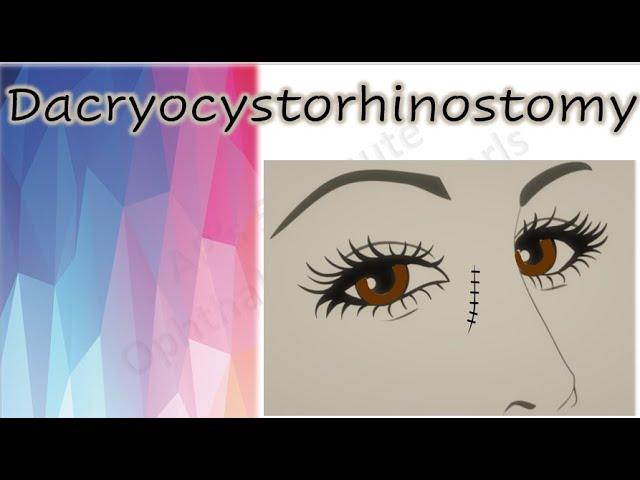 Dacryocystorhinostomy  |  DCR