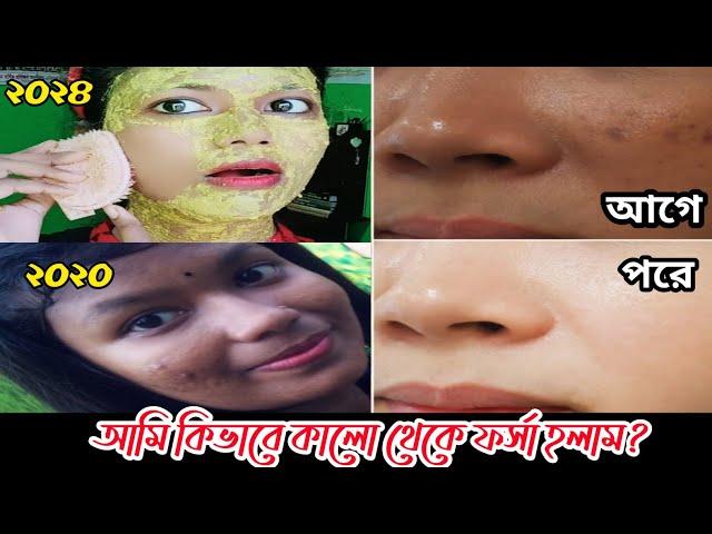 এটা লাগিয়ে কালো থেকে ফর্সা হলাম | My skin whitening home remedies | skin brightening facial