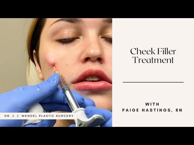Cheek Filler Treatment | Dr. J. J. Wendel Plastic Surgery | Nashville