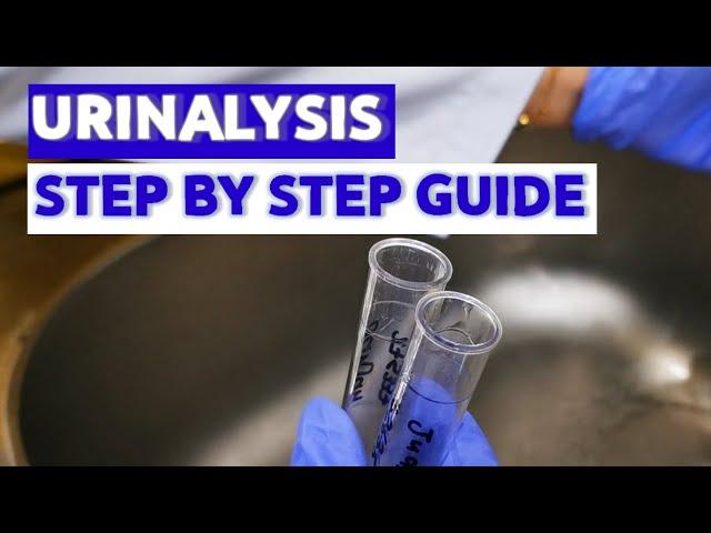 HOW TO DO URINALYSIS?| |MEDICAL LABORATORY SCIENCE