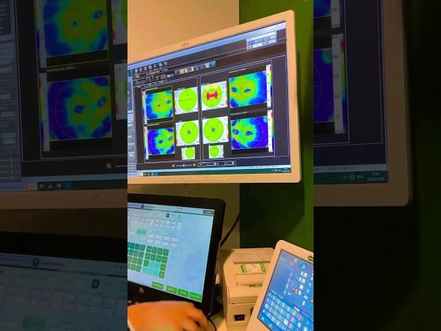 My Enhanced OCT Scan  @SpecsaversOfficial  #eyetest  #octscan #eyeglasses #scan  #fypシ゚viral