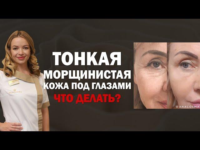 ТОНКАЯ КОЖА ПОД ГЛАЗАМИ ⁉️‍МОРЩИНЫ ПОД ГЛАЗАМИ  ЧТО ДЕЛАТЬ 