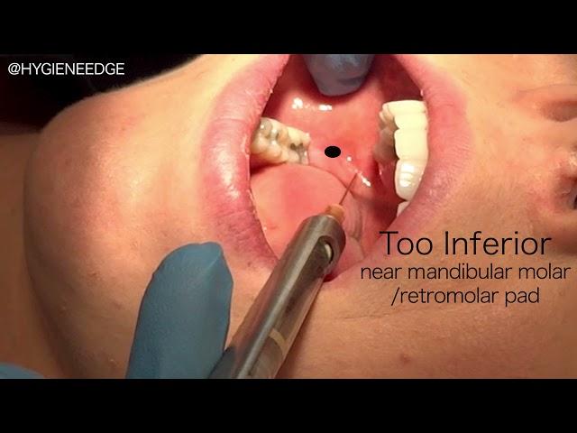 IA Injection Site Review