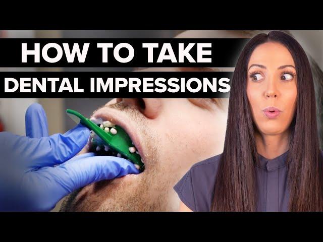 Surviving Dental Impressions (what to expect)