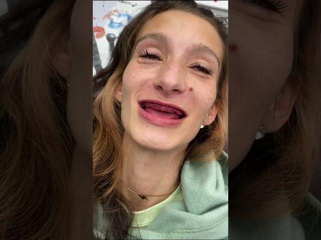 Dentist Gives Woman Who Had Teeth Removed Her Smile Back