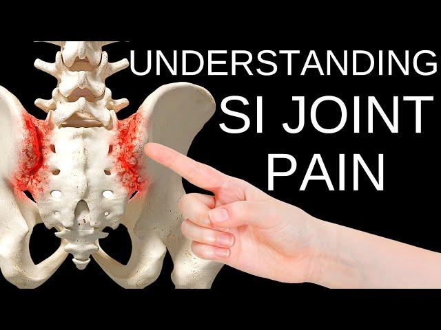 Simple Solutions to Sacroiliac SI Joint Pain