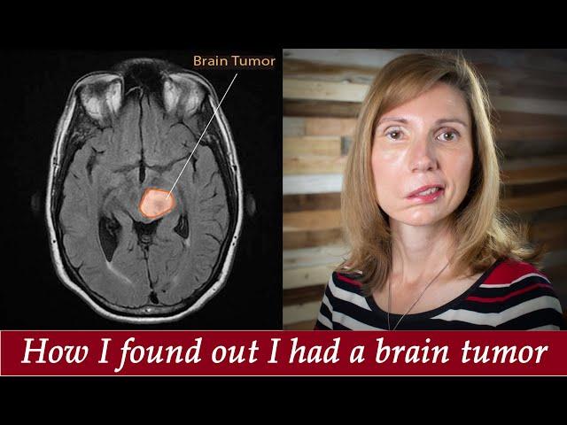 Brain Tumor Journey pt 1: From dizzy spells, headaches, vertigo, to diagnosis, Jodi Orgill Brown