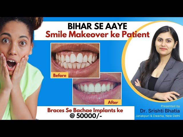 Smile Makeover for Patient from Bihar: Dr. Srishti Bhatia #smilemakeover #smile