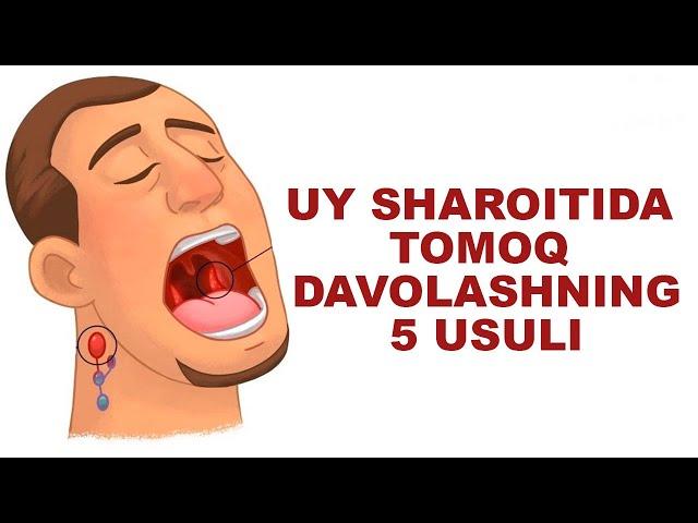 Tomoq Og'rig'ini Davolashning 5 Usuli