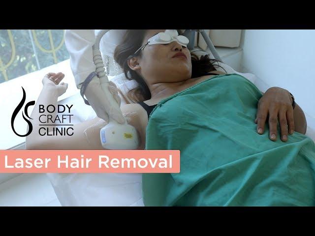 Inside The Bodycraft Clinic | Laser Hair Reduction ft. Dr. Mikky Singh