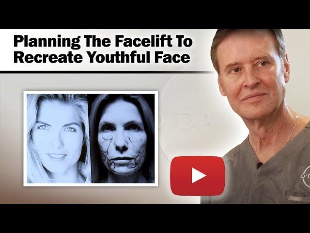 Female Facelift - Planning The Facelift To Recreate The Youthful Face - Dr. Gerald O'Daniel