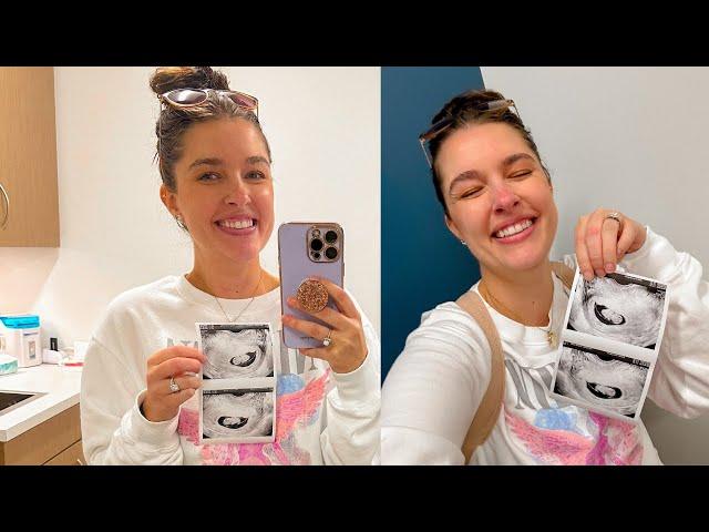 Vlog | 8 Week Ultrasound, Updates, Graduation Day, & All the Emotions!