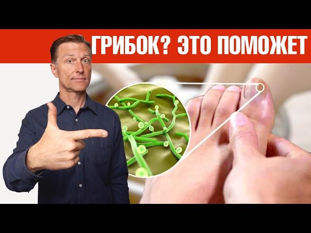 Как избавиться от грибка ногтей НАВСЕГДА?