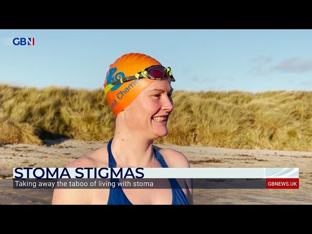 Rachel Sweeney speaks to Gill Castle about taking away the stigma surrounding stomas