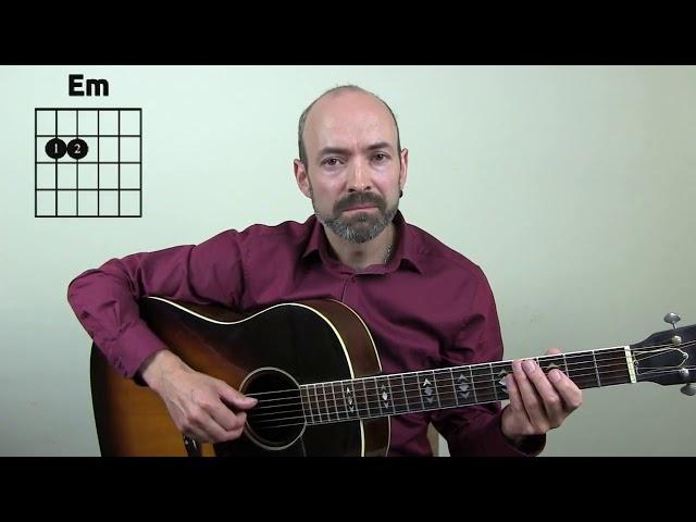 Acoustic Guitar Basics - learn Acoustic Guitar