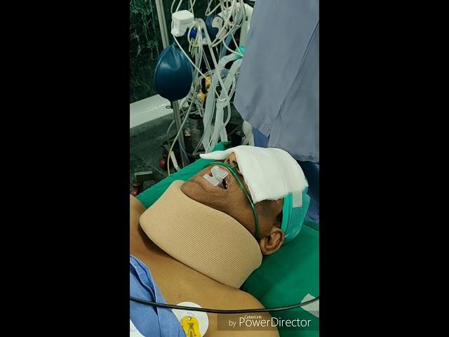 Awake Fibreoptic Intubation