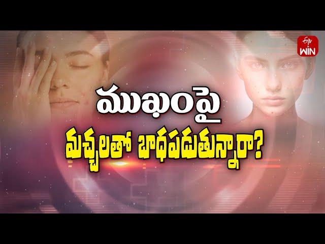 Remedies for black spots on Face | Sukhibhava | 7th Dec 2024 | ETV Life