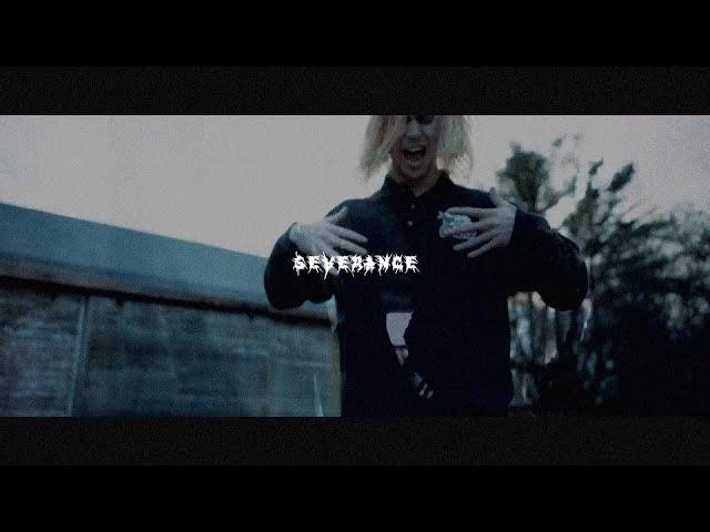 [FREE] GIZMO X LUNAR VISION TYPE BEAT - 'SEVERANCE'