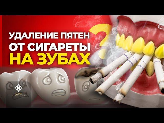  (subtitled) How to Clean Cigarette Stains on Teeth? - Lema Dental Clinic