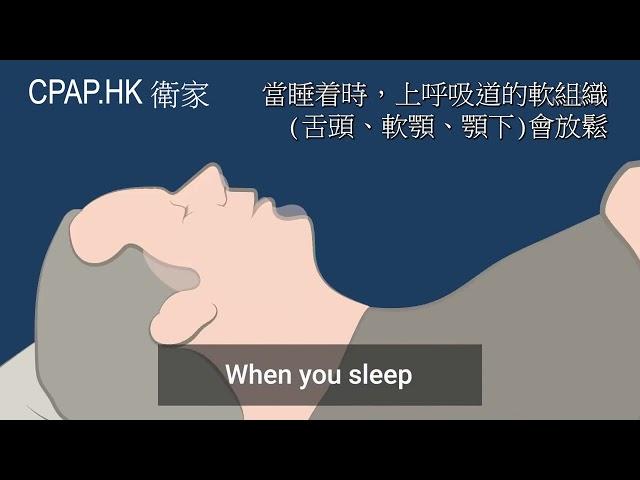 為何會打鼻鼾? 什麽是睡眠窒息症? 睡眠呼吸機是什麼? 歡迎聯絡CPAP.HK衛家睡眠呼吸機專門店讓我們為您詳細講解及免費提供建議。電話 Tel: 6645 8282