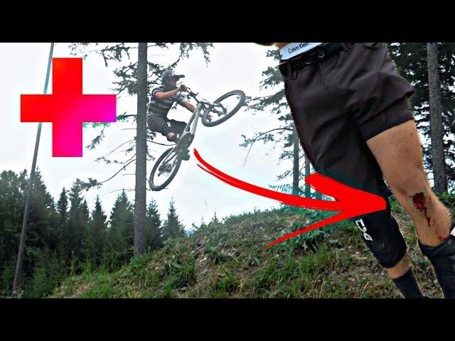 HORROR CRASH an den Wexl Trails 