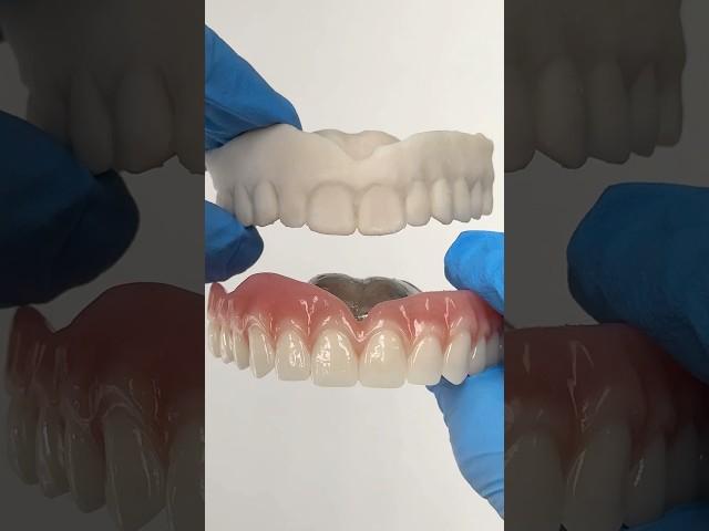 Before and After Chrome Cobalt Denture #lsk121shorts #dentist #teeth