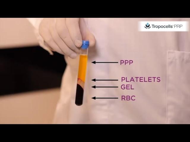 Tropocells PRP 11ml