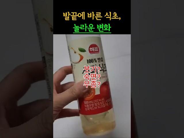 발끝에 식초바르면?다리피로,붓기,수면문제까지, 밤마다 발을 닦는 습관, 식초효능