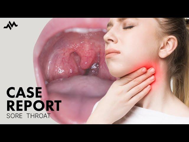 Sore throat and painful swallowing - Case Report