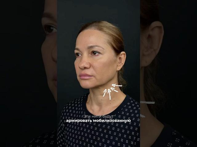 Фейс лифтинг. Аквалифтинг. Доктор КОПАСОВ