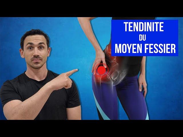 Tendinite du Moyen Fessier : Traitements, Étirements et Exercices Kiné