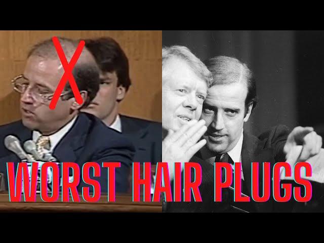 Joe Biden Worst Hair Plugs in History