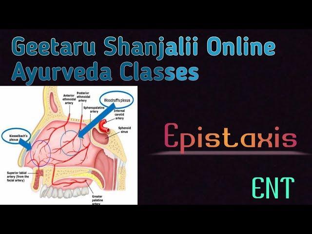 Epistaxis by Geetaru Shanjalii online Ayurveda Classes BAMS shalakyatantra ENT lectures