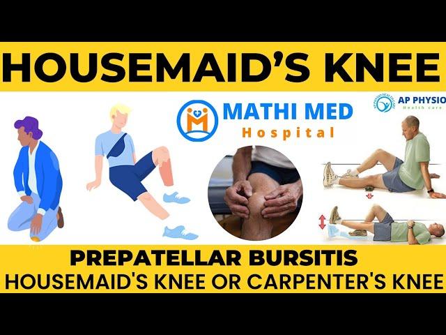 Housemaid's knee | Carpenter's knee | Prepatellar Bursitis | #kneepain #exercise #annavi