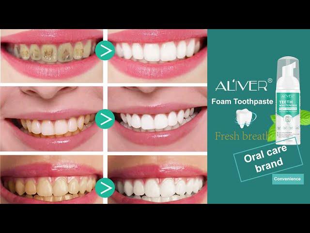 ALIVER Teeth Whitening Foam Toothpaste | Smile With Confidence