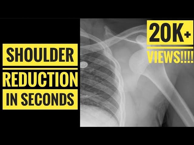 Quick Drug Free Awake Shoulder Reduction Technique