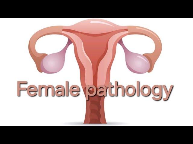 Female pathology 3rd lecture.