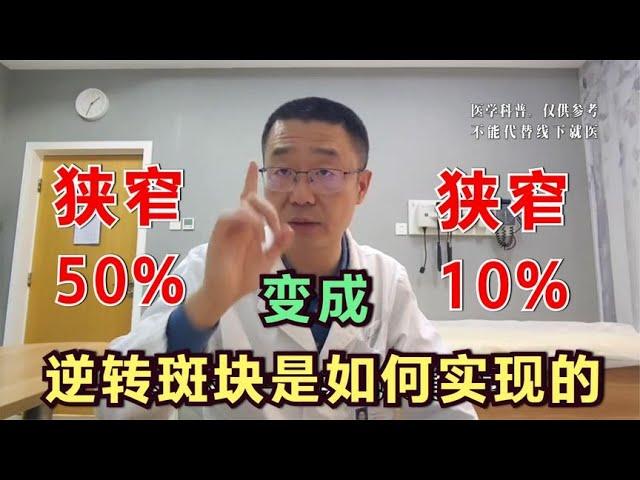 心脏冠状动脉斑块，狭窄从50%降到10%，怎么做到的？如何逆转斑块